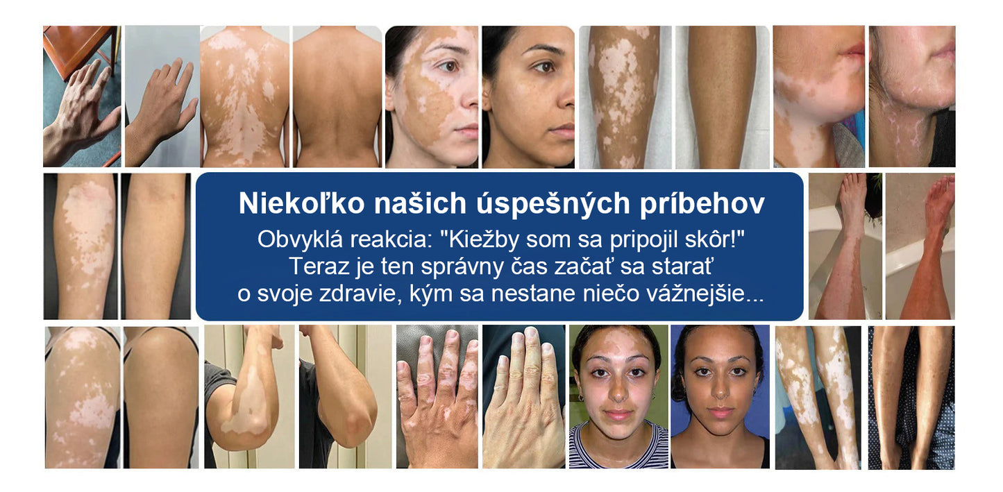 🌿Laleia® Piperín Repigmentačný aktivačný sprej