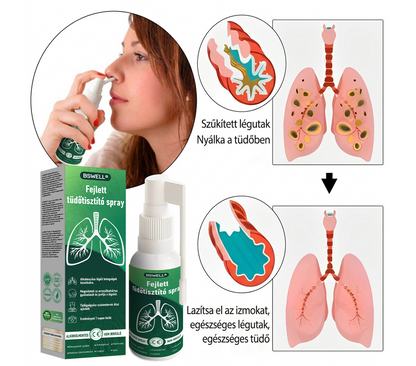 🍀🍀 BSWELL® Fejlett Tüdőtisztító Spray-✅ Támogatja a tüdő, a hörgők és az orrmelléküregek egészségét, hozzájárul a légzőrendszer megfelelő működéséhez, és megkönnyítheti a légzést.