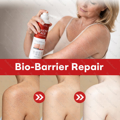 🎉Limited-time discount✨CleraNaure® Salicylic Acid Keratosis Spray | keratosis pilaris on arms & body