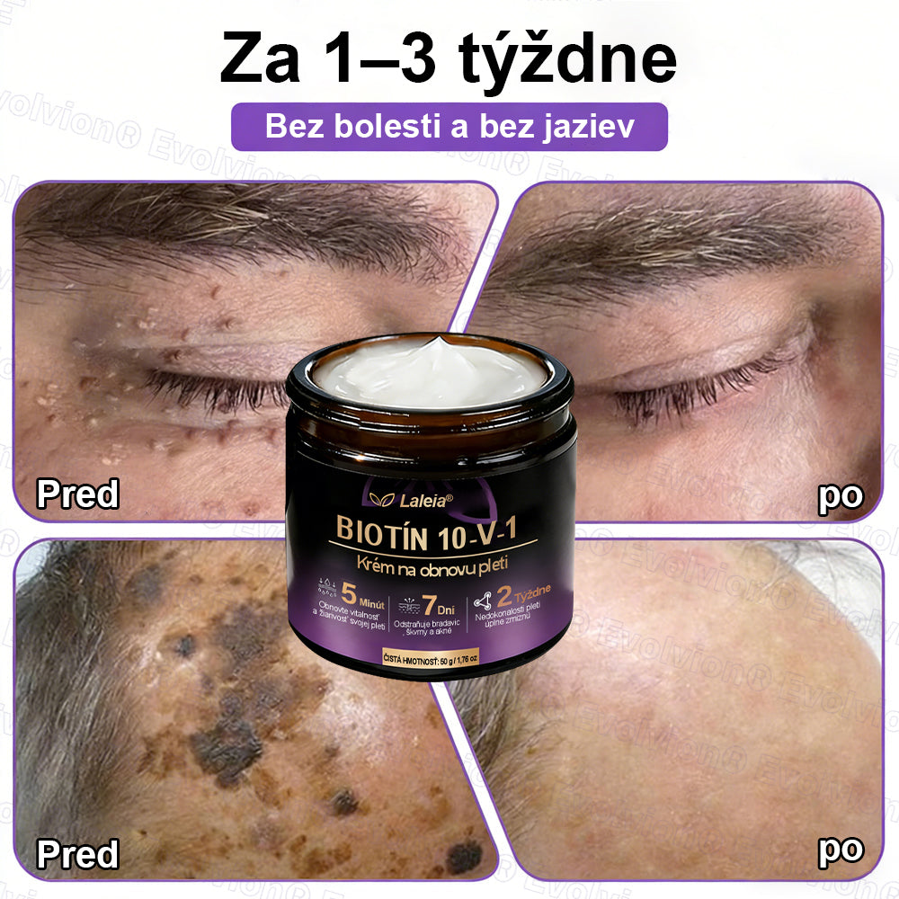 Laleia® Biotin 10 v 1 kožný regeneračný krém✨