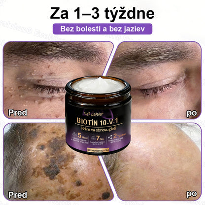Laleia® Biotin 10 v 1 kožný regeneračný krém✨