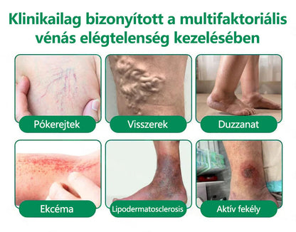 🌿CleraNaure® VeinTarget Mikrotűs Pólya 🗽 Azonnali Enyhülés, Hosszú Távú Eredmények🌿🌿