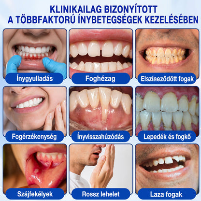 CleraNaure®💎 GumRevive – fejlett gél az íny és a fogágy ápolására🇭🇺👨‍⚕️✅🦷