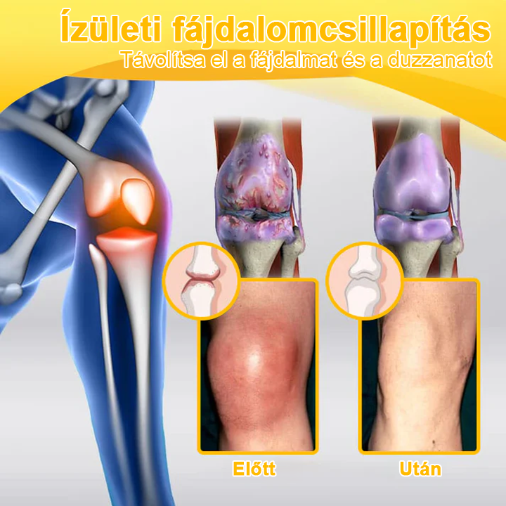 Buzora® Botulinum Toxin és Méhméreg Fájdalomcsillapító Csontgyógyító Krém🌿