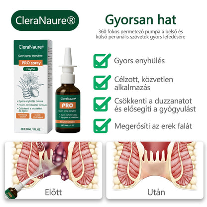 🎁 Időszakos ajánlat | CleraNaure® Gyors Aranyér PRO Spray🎁