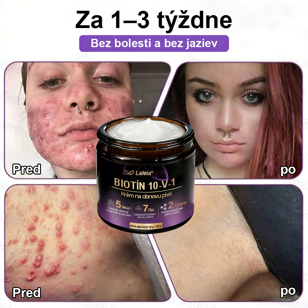 Laleia® Biotin 10 v 1 kožný regeneračný krém✨