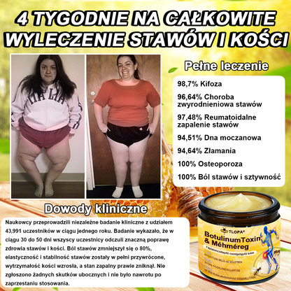 Buzora® Botulinum Toxin és Méhméreg Fájdalomcsillapító Csontgyógyító Krém🌿