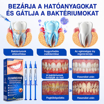 CleraNaure®💎 GumRevive – fejlett gél az íny és a fogágy ápolására🇭🇺👨‍⚕️✅🦷