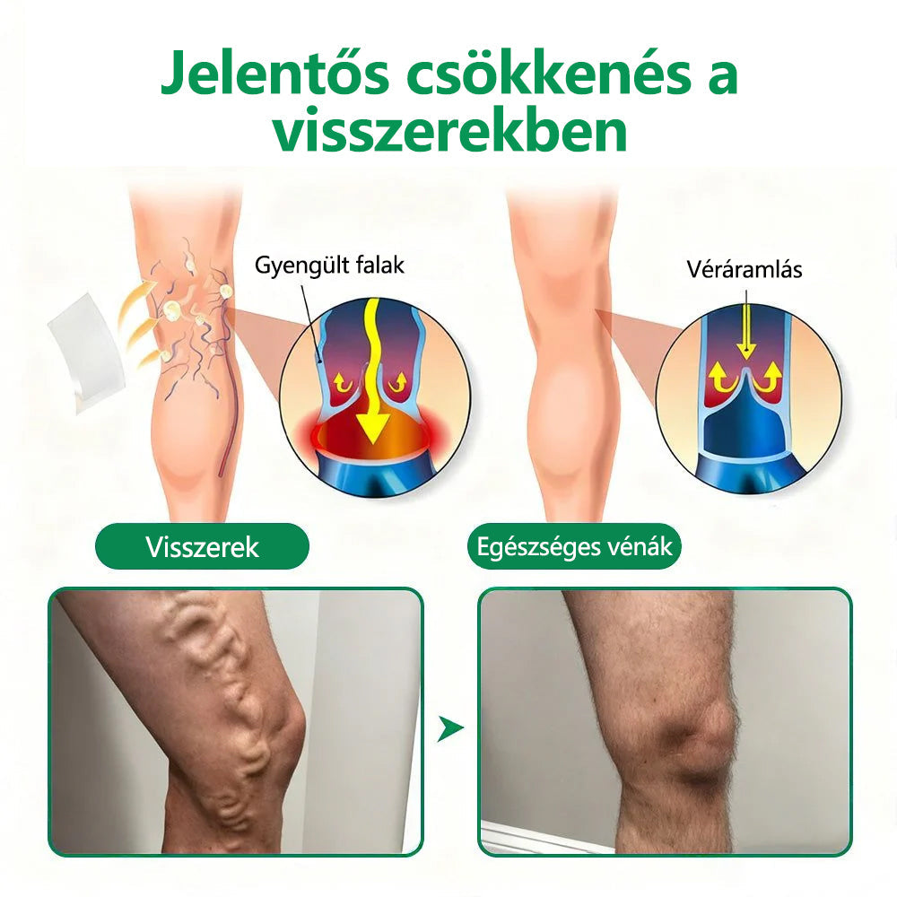 🌿CleraNaure® VeinTarget Mikrotűs Pólya 🗽 Azonnali Enyhülés, Hosszú Távú Eredmények🌿🌿
