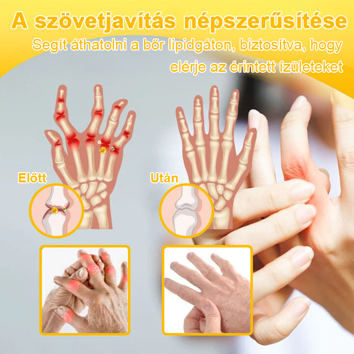 Buzora® Botulinum Toxin és Méhméreg Fájdalomcsillapító Csontgyógyító Krém🌿