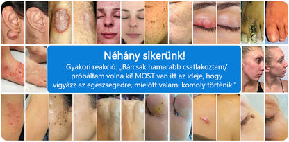 🏆CleraNature® Magnéziumos Spray – Gyors Enyhülés Viszkető, Vörös és Érzékeny Bőrre (Még Intim Területeken is)🏆