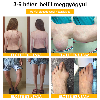 Buzora® Botulinum Toxin és Méhméreg Fájdalomcsillapító Csontgyógyító Krém🌿