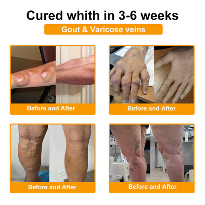 Buzora® Botulinum Toxin és Méhméreg Fájdalomcsillapító Csontgyógyító Krém🌿