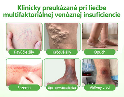 🔥Laleia® VeinHeal náplasť s mikroihličkami