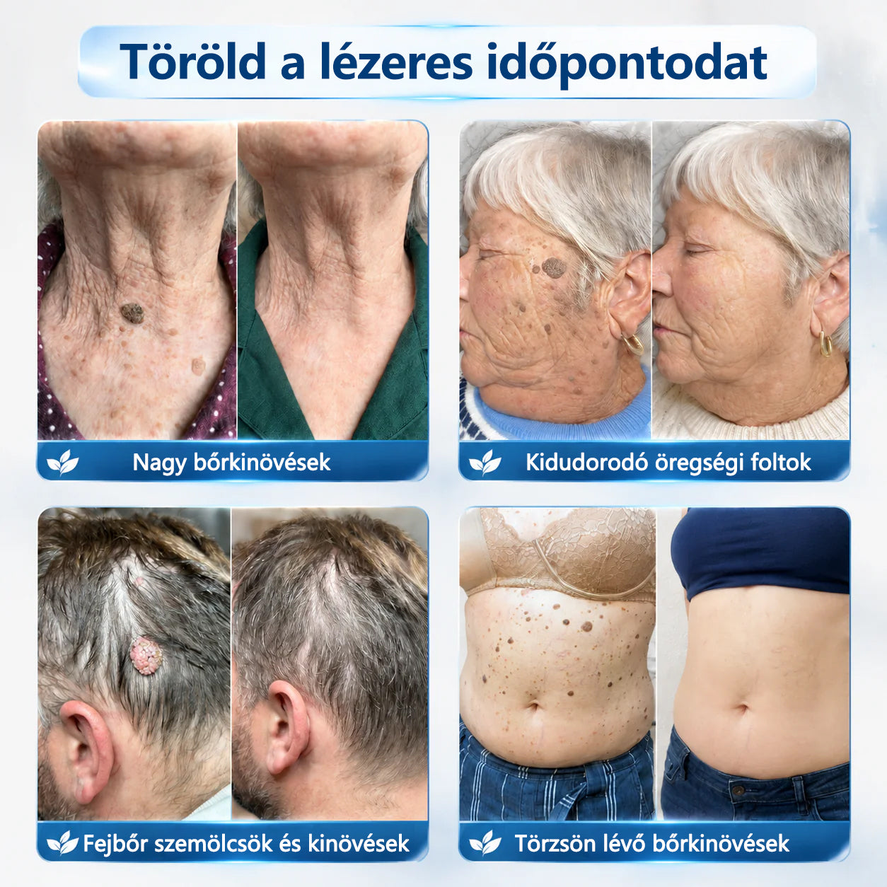 Hivatalos áruház🎉CleraNaure® 7 napos pigmentfolt- és bőrhiba-eltüntető kezelés (Fájdalommentes, hegmentes görgős applikátor)