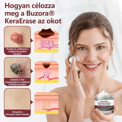Buzora® kettős hatású megújító krém🎁✨