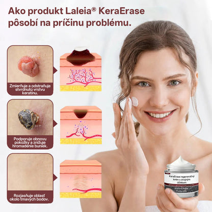 ⭐⭐ Laleia® KeraErase obnovujúci krém s dvojitým účinkom