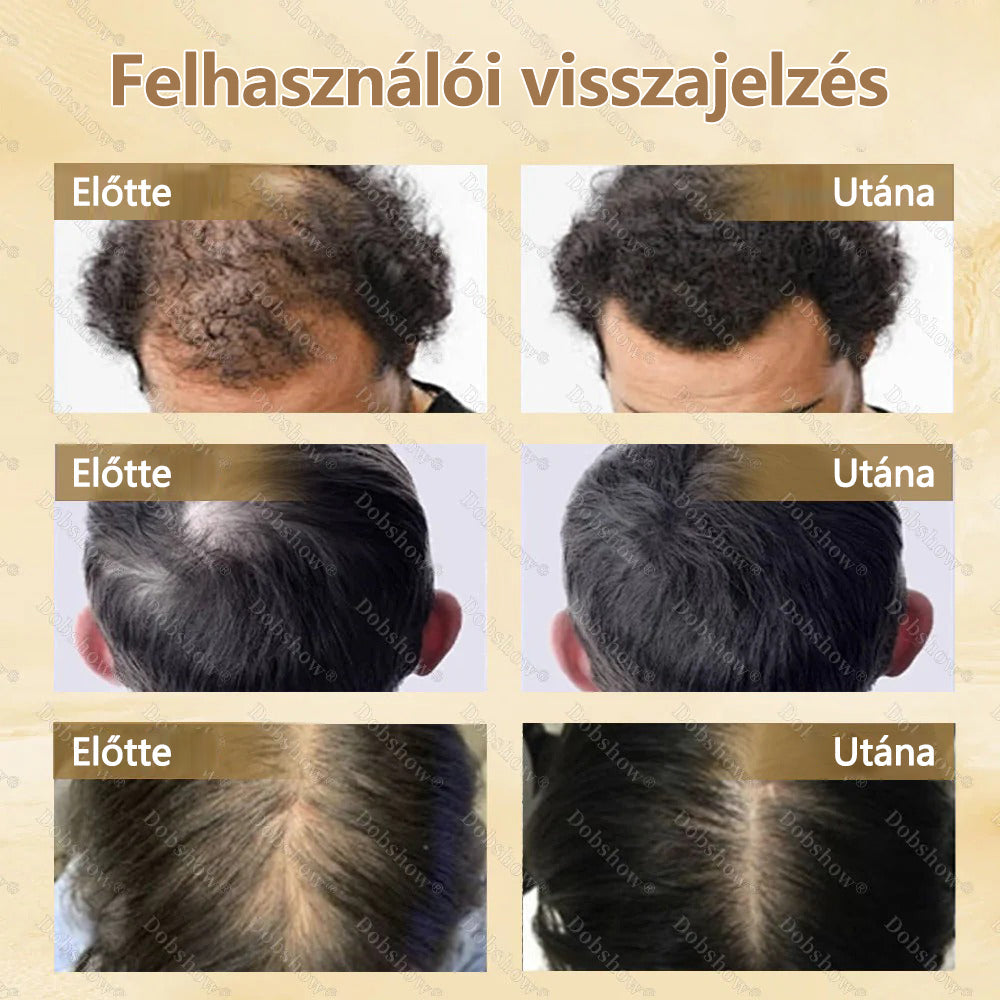 🔥 Hajnövesztő kapszula | CleraNaure® hajnövesztő kapszula | Nanotechnológiás behatolás, mélyen a hajgyökerekig