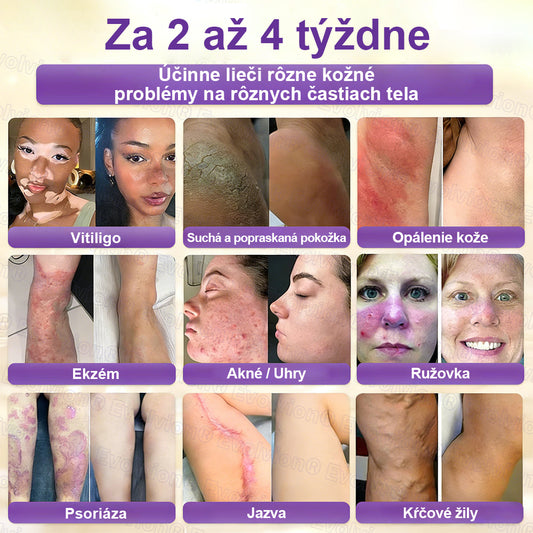 Laleia® Biotin 10 v 1 kožný regeneračný krém✨