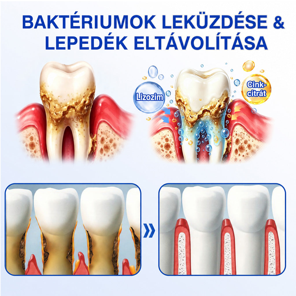 CleraNaure®💎 GumRevive – fejlett gél az íny és a fogágy ápolására🇭🇺👨‍⚕️✅🦷