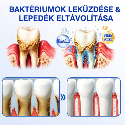 CleraNaure®💎 GumRevive – fejlett gél az íny és a fogágy ápolására🇭🇺👨‍⚕️✅🦷