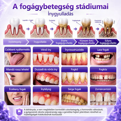 CleraNaure® Ínygyulladás és Fogágyproblémák Kezelésére Szolgáló Fogkrém