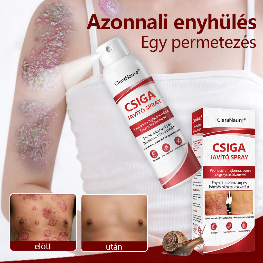 CleraNature® Bálnazsír Spray Viszkető, Hámló Psoriasisra Hajlamos Bőrre⭐⭐⭐