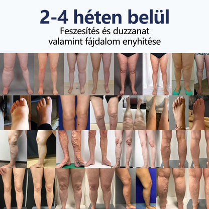 Buzora® keringést támogató krém duzzadt, nehéz lábakra