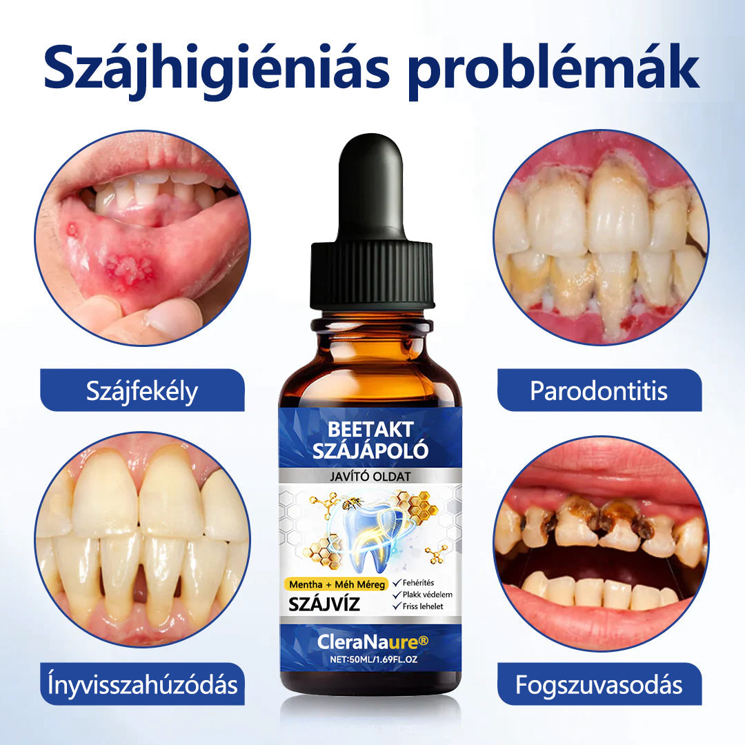 💎CleraNaure® BeeTakt Szájápoló Javító Oldat ✨💙