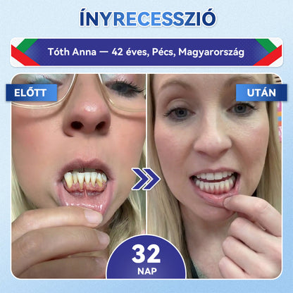 🦷CleraNaure® Tideglusib Fog & íny Javító mikrotűs tapasz | Fejlett őssejt-aktiváló fogcsíkok (újjáépíti a fogzománcot és a dentint • erősíti az ínyt • megszünteti a fogkövet és a szagokat • megállítja a fogérzékenységet) 3.0