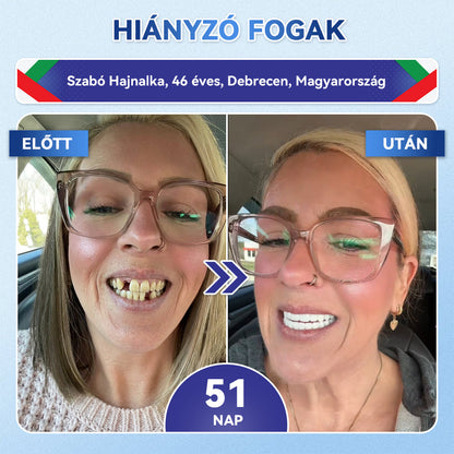 🦷CleraNaure® Tideglusib Fog & íny Javító mikrotűs tapasz | Fejlett őssejt-aktiváló fogcsíkok (újjáépíti a fogzománcot és a dentint • erősíti az ínyt • megszünteti a fogkövet és a szagokat • megállítja a fogérzékenységet) 3.0
