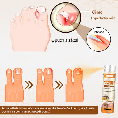 ⭐⭐Laleia® NailRescue sprej s včelím jedom