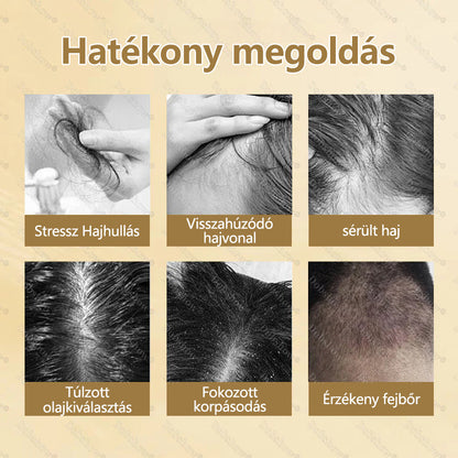 🔥 Hajnövesztő kapszula | CleraNaure® hajnövesztő kapszula | Nanotechnológiás behatolás, mélyen a hajgyökerekig