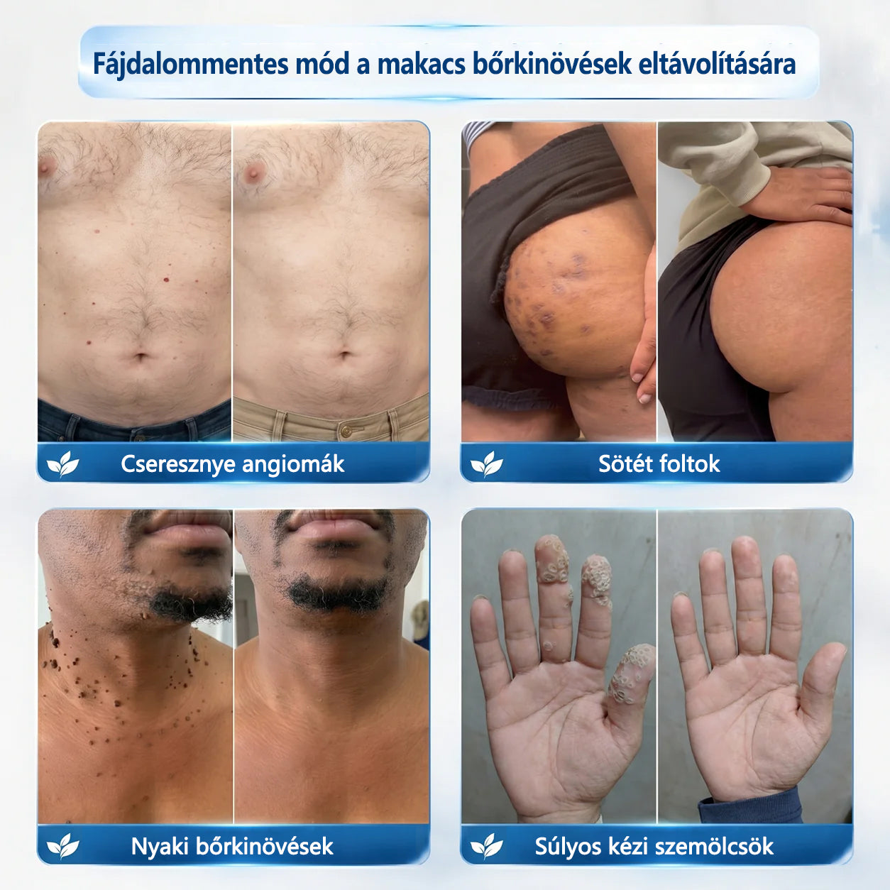 Hivatalos áruház🎉CleraNaure® 7 napos pigmentfolt- és bőrhiba-eltüntető kezelés (Fájdalommentes, hegmentes görgős applikátor)