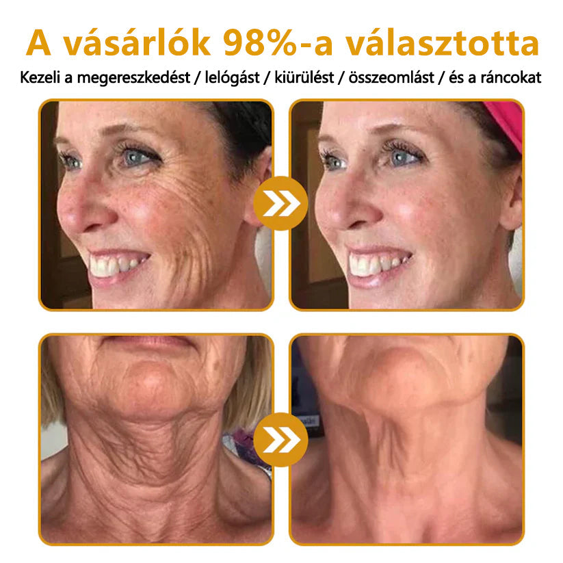 🍯🍯CleraNaure® Méhméreg Bőrregeneráló Krém🍯