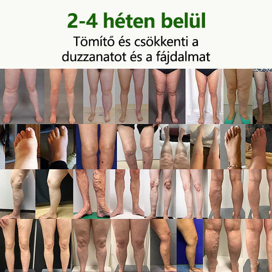 🛡️🛡️CleraNaure® FluidEase Professzionális krém🛡️🛡️🛡️