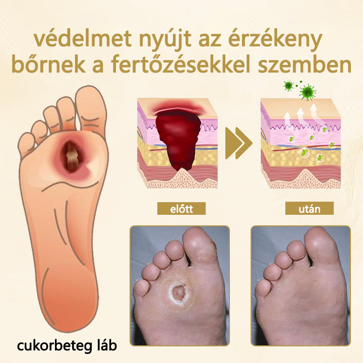 🌿Buzora® Diabéteszes láb gyógyító spray - Méhméreg infúzióval