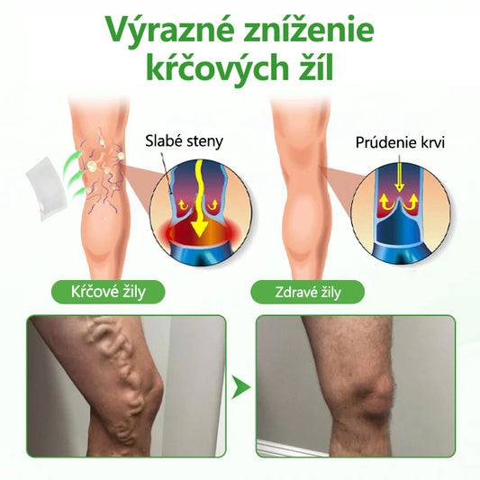 🔥Laleia® VeinHeal náplasť s mikroihličkami