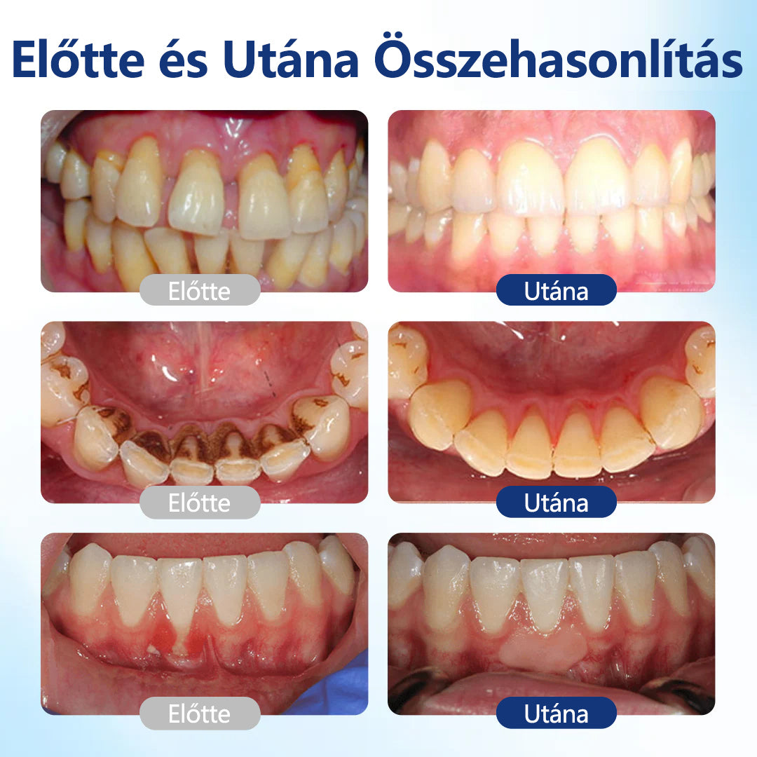 💎CleraNaure® BeeTakt Szájápoló Javító Oldat ✨💙