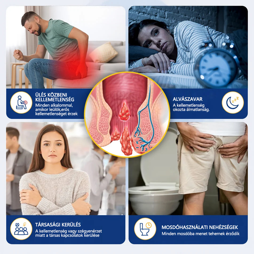 CleraNaure® ComfortShield Aranyér Nyugtató Kenőcs🔵🔵🔵🔵