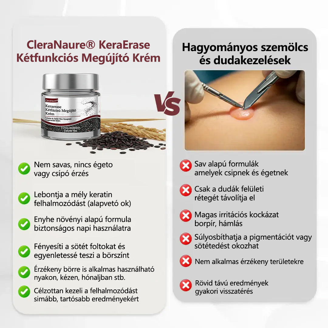 🧡Hivatalos áruház👨‍⚕️ CleraNaure® KeraErase - Kettős hatású bőrfiatalító krém 👨‍⚕️ (Kettős hatású fiatalítás – simítja a kiemelkedő dudorokat és lebontja a mélyen lerakódott keratint savak és irritáció nélkül)🌙