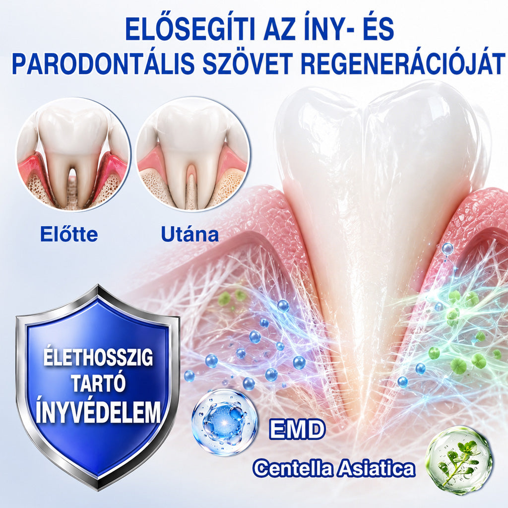 CleraNaure®💎 GumRevive – fejlett gél az íny és a fogágy ápolására🇭🇺👨‍⚕️✅🦷