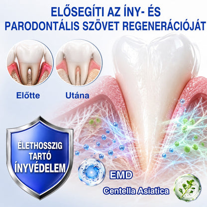 CleraNaure®💎 GumRevive – fejlett gél az íny és a fogágy ápolására🇭🇺👨‍⚕️✅🦷