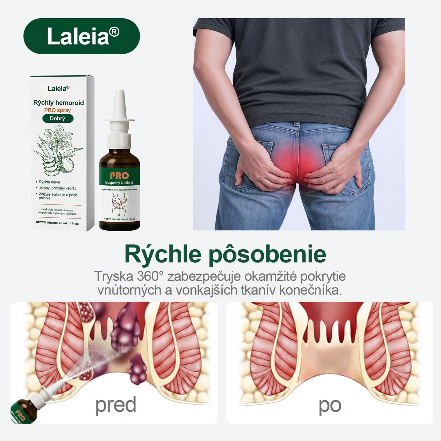🔥Laleia® Rýchly hemoroidný PRO sprej