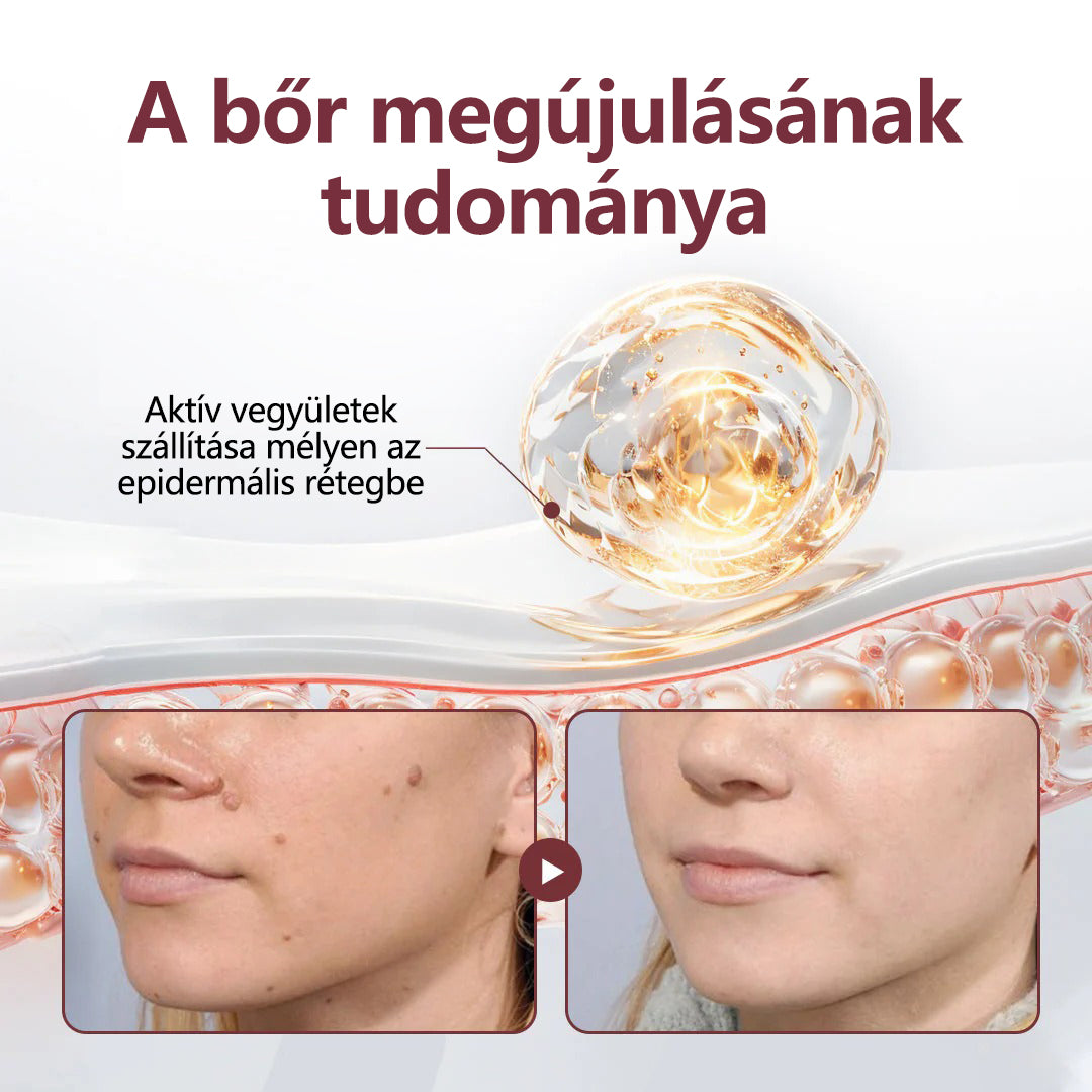 Buzora® kettős hatású megújító krém🎁✨