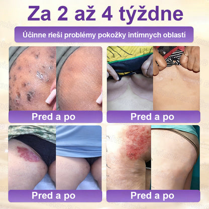 Laleia® Biotin 10 v 1 kožný regeneračný krém✨