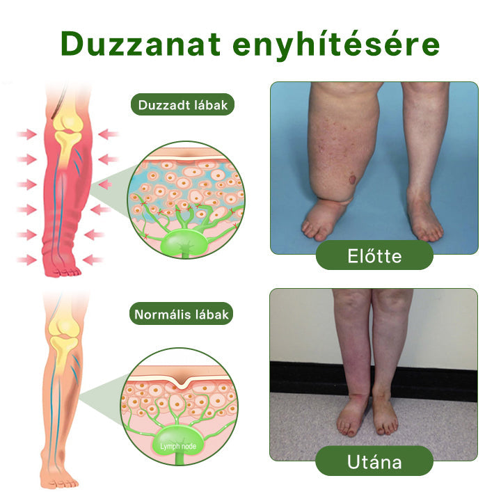 🌿Buzora® professzionális lábápoló krém🎁✨