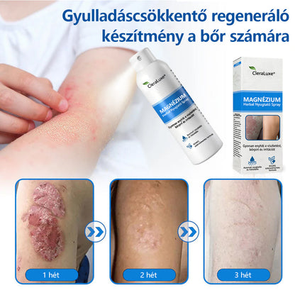 🏆CleraNature® Magnéziumos Spray – Gyors Enyhülés Viszkető, Vörös és Érzékeny Bőrre (Még Intim Területeken is)🏆