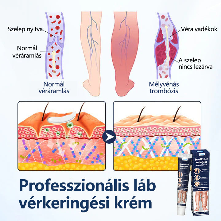 Buzora® keringést támogató krém duzzadt, nehéz lábakra