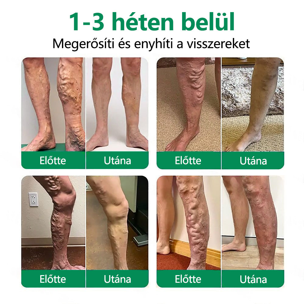 🌿CleraNaure® VeinTarget Mikrotűs Pólya 🗽 Azonnali Enyhülés, Hosszú Távú Eredmények🌿🌿